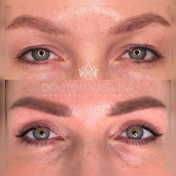 В глаза смотри: что делать с нежной кожей век? От косметологии и хирургии до массажа и косметики 