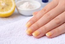Ногти сыграли на жёлтой ноте: большинство винит грибок, а причина совсем в другом