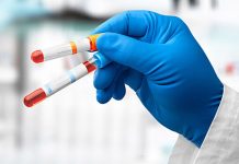 Найден способ выявить болезнь Паркинсона до появления тремора