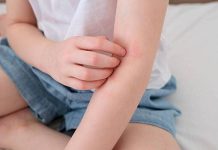 Что такое импетиго и как происходит заражение