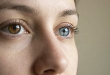 Офтальмолог Левина: изменение радужной оболочки глаза может быть симптомом меланомы