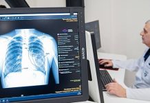 Минздрав: пациенты с ВИЧ и туберкулезом получают медпомощь в РФ бесплатно