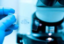 AdvSci: агрессивные раковые опухоли могут разрастаться за счет жиров