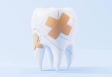 Что делать, если откололся кусочек зуба: инструкция от стоматолога